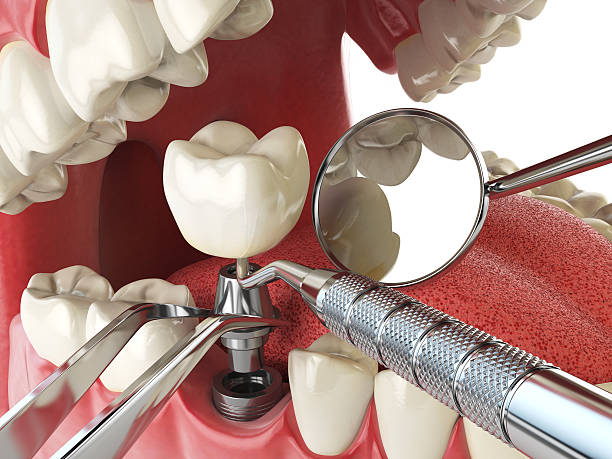 Best Emergency Treatment for Toothache in Pingree Grove, IL